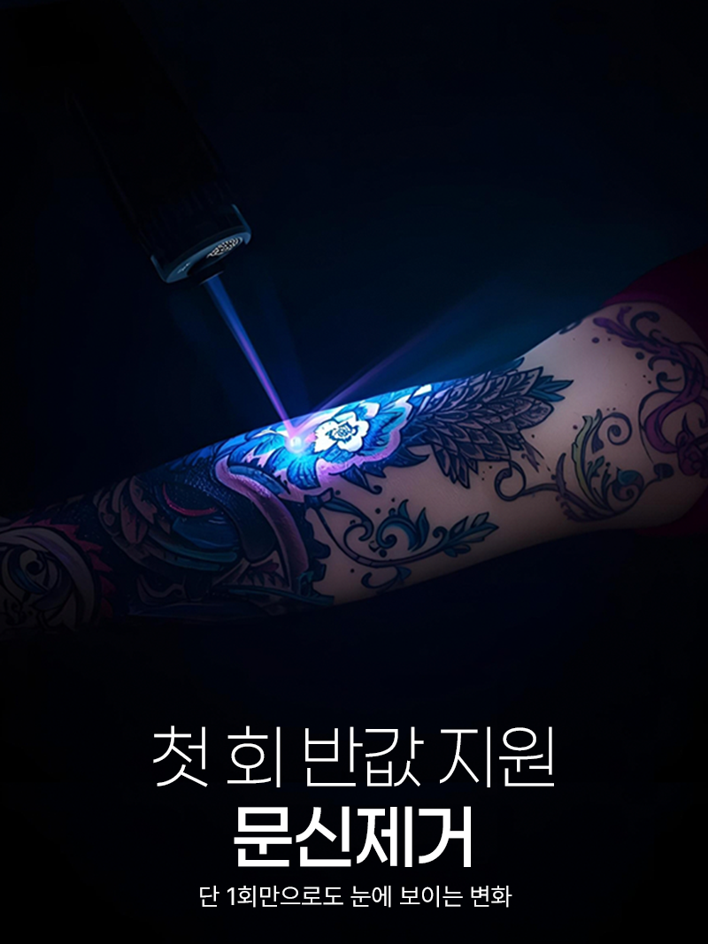 [문신제거] 첫 회 반값 지원