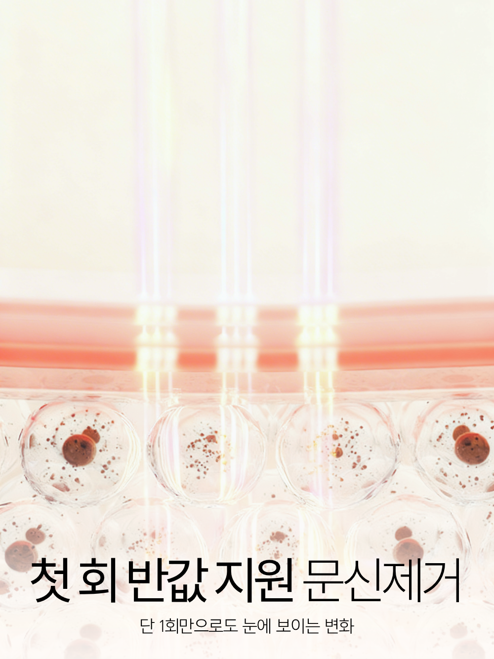 [문신제거] 첫 회 반값 지원