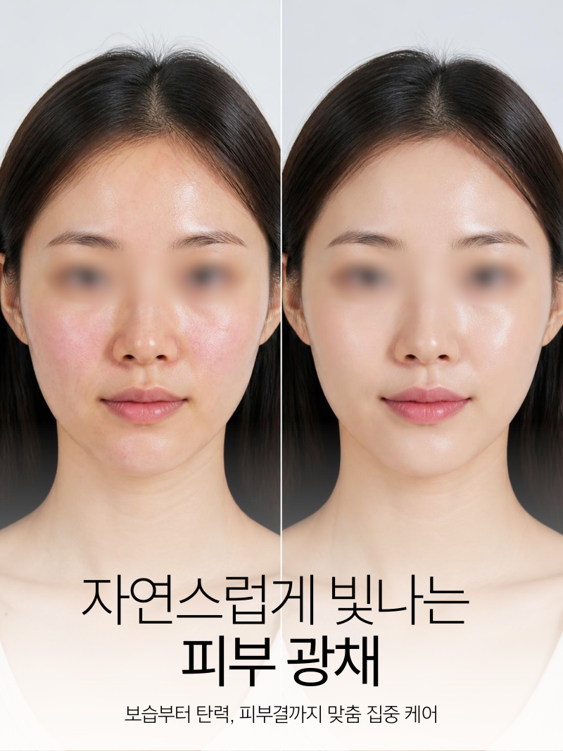 [스킨부스터] 3종 이벤트